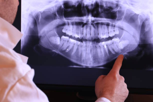 Best Lost Filling or Crown Replacement in Mancelona, MI